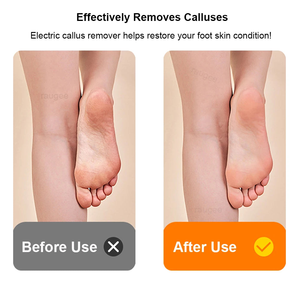 Electric Foot Grinder Rechargeable Automatic Portable Foot Callus Remover Rubbing Pedicure Polishing Hard Dead Skin Removal Tool