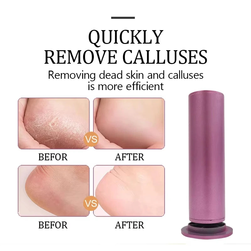 Electric Foot Callus Remover USB Wired Adjustable Speed Pedicure Tool Professional Dead Skin Eraser for Home Foot Care