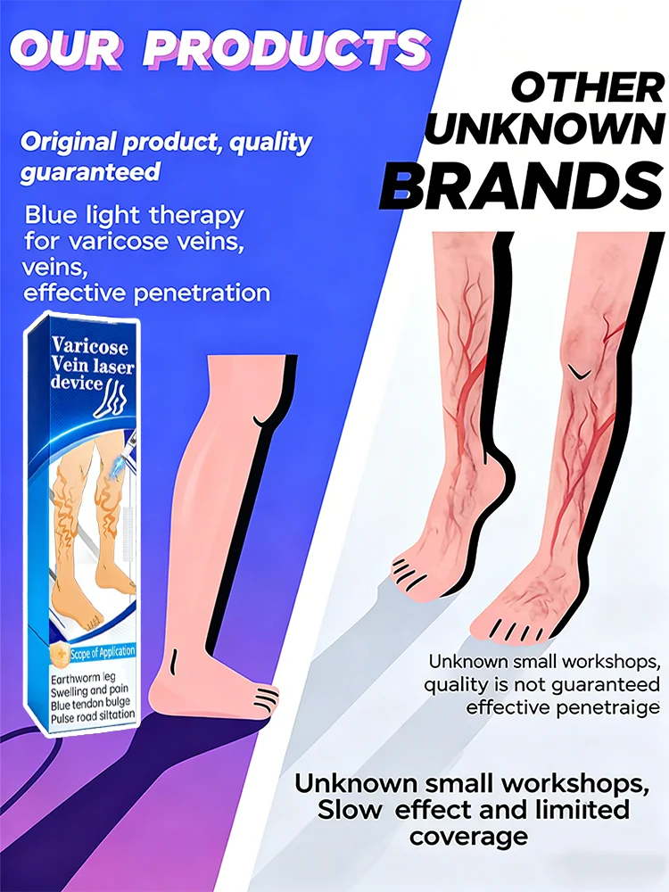 Varicose Vein  Remover