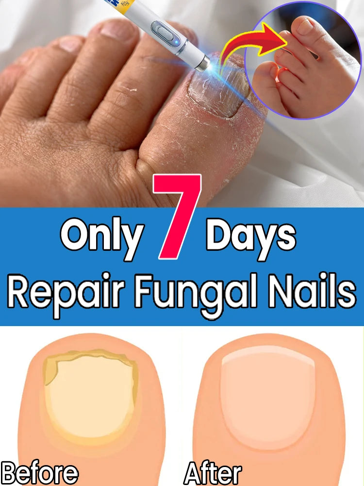 Nail polish lamp for bad nails