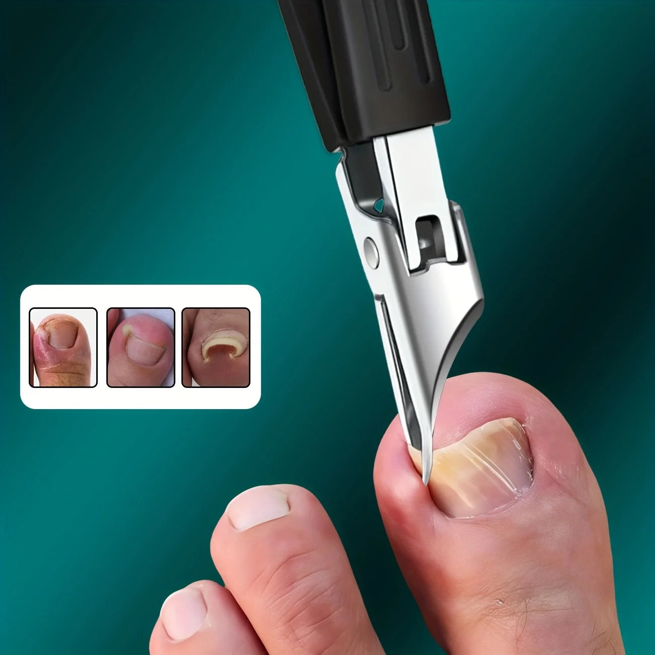Thick Ingrown Nails Heavy Duty Stainless Steel Trimmer Safety Soft Grip Ultra Sharp 25 Degree Angled Blade Seniors Splash Proof
