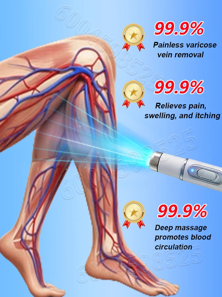 Varicose Vein  Remover