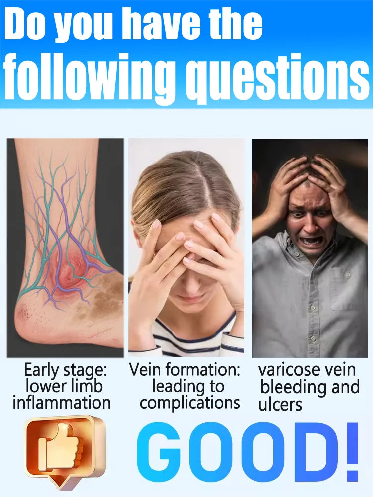 Varicose Vein  Remover