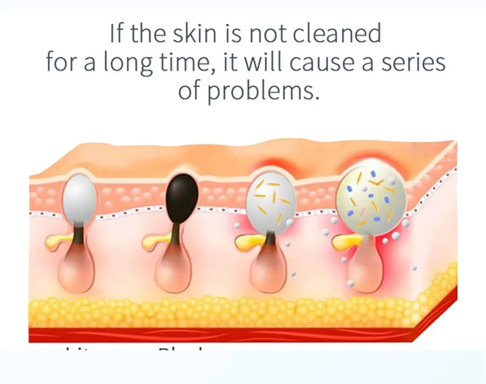 Experience advanced skincare with the new small bubble oxygen injection instrument. This Hydra Dermabrasion device combines Aqua Facial Cleaning, Suction for blackhead removal, and gentle exfoliation for clear, radiant skin.