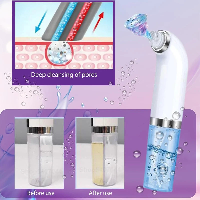 Revitalize your skin with the Water Dermabrasion Hydra Peeling Machine, offering Aqua Facial Clean and Blackhead Removal for a radiant glow.