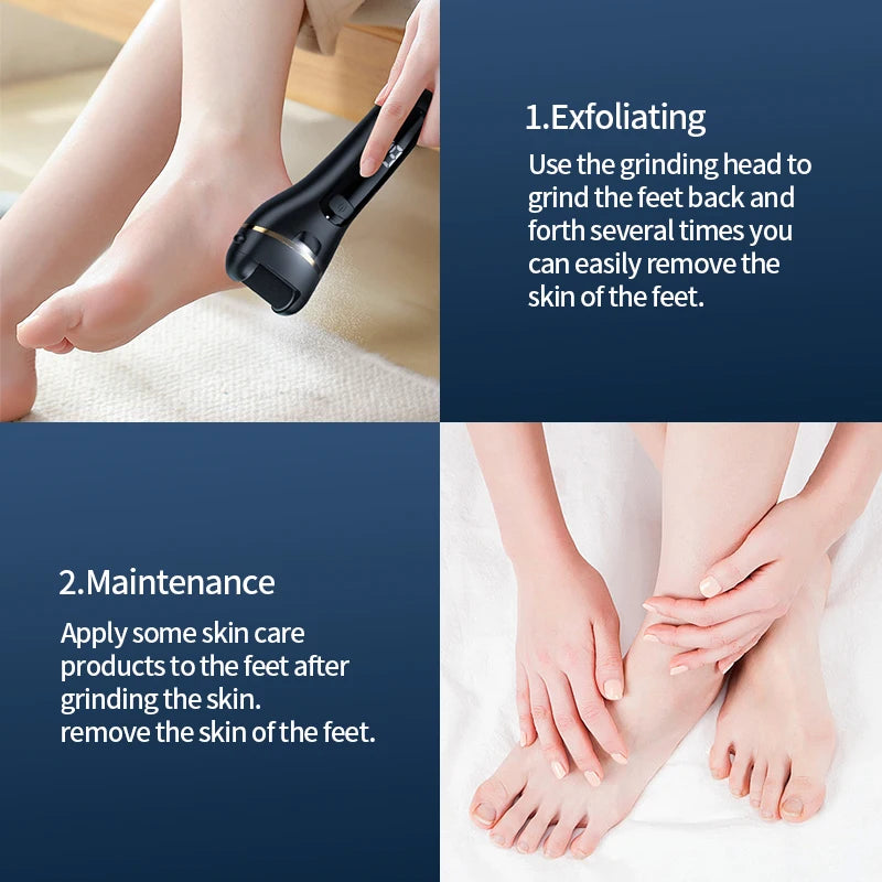 Rechargeable Callus Remover