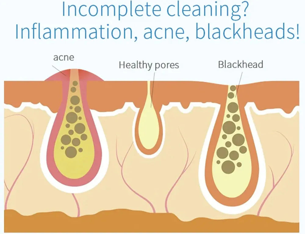 Experience advanced skincare with the new small bubble oxygen injection instrument. This Hydra Dermabrasion device combines Aqua Facial Cleaning, Suction for blackhead removal, and gentle exfoliation for clear, radiant skin.