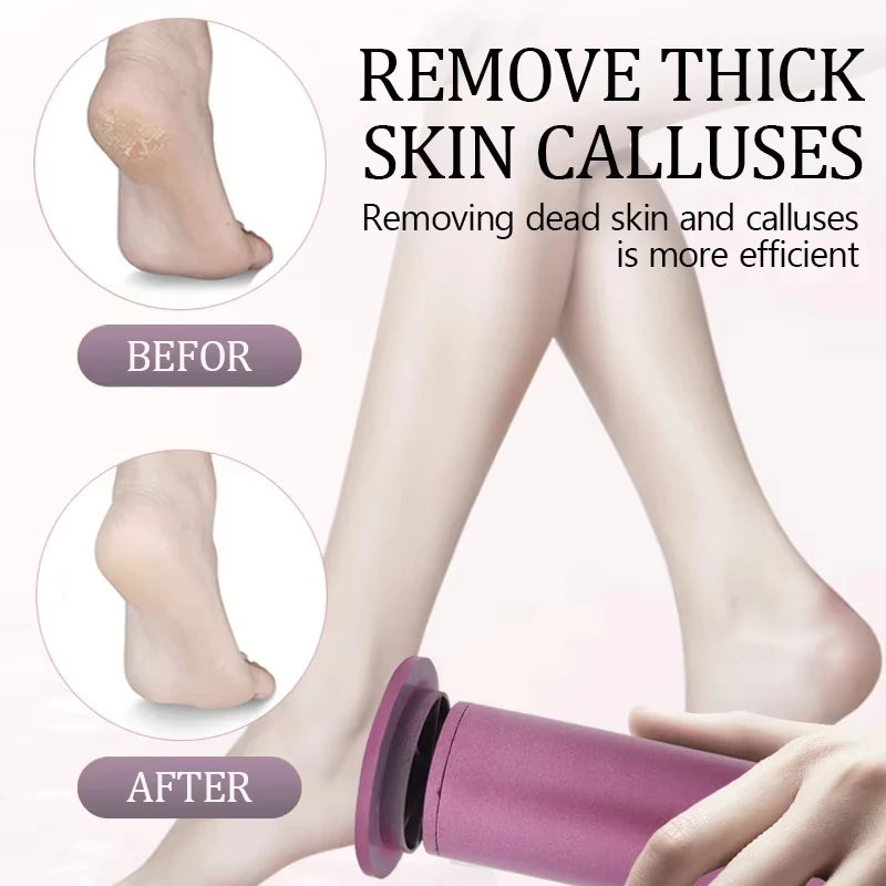 Electric Foot Callus Remover USB Wired Adjustable Speed Pedicure Tool Professional Dead Skin Eraser for Home Foot Care