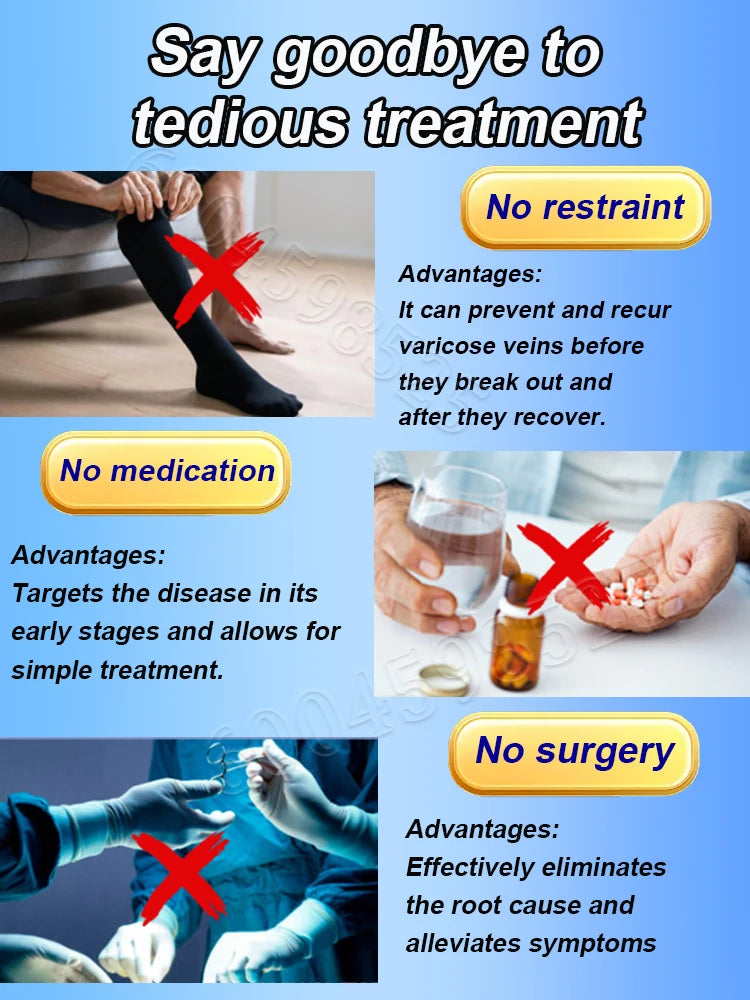 Varicose Vein  Remover