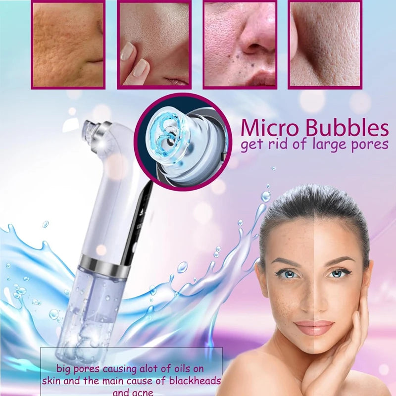 Revitalize your skin with the Water Dermabrasion Hydra Peeling Machine, offering Aqua Facial Clean and Blackhead Removal for a radiant glow.