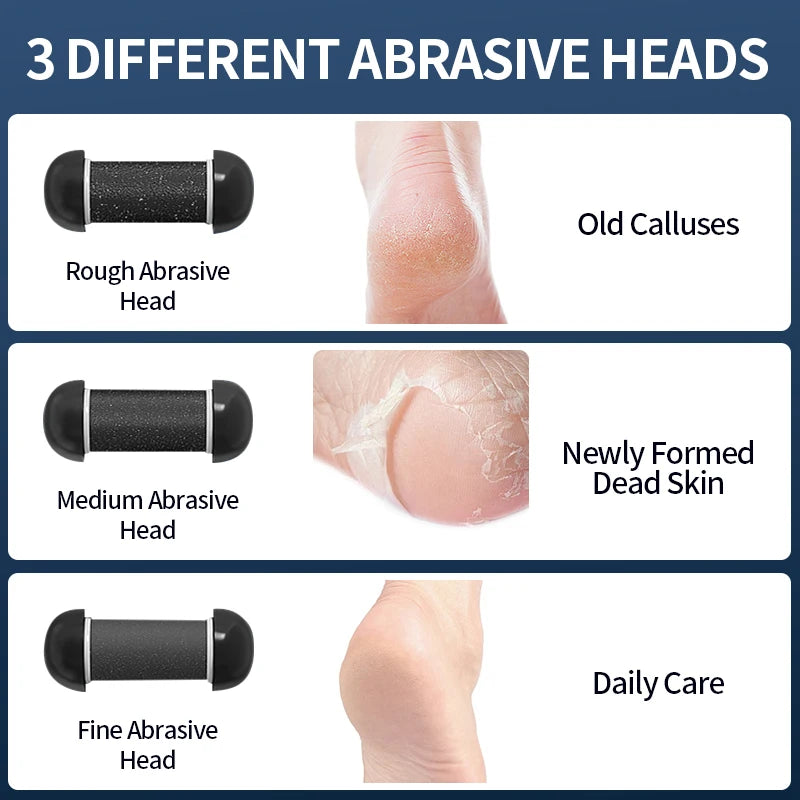 Rechargeable Callus Remover