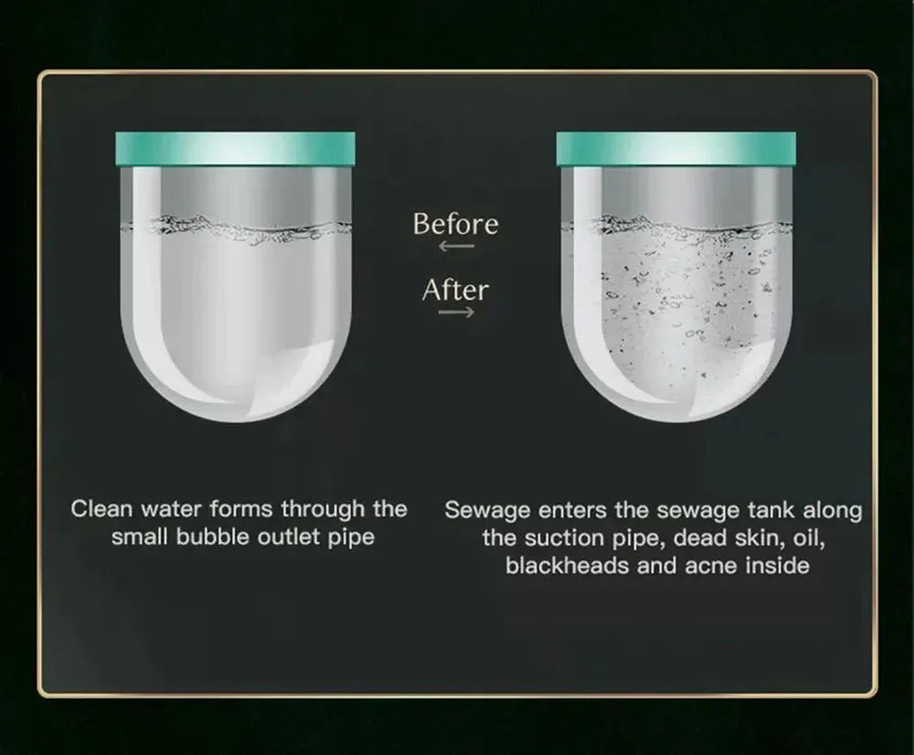 Experience advanced skincare with the new small bubble oxygen injection instrument. This Hydra Dermabrasion device combines Aqua Facial Cleaning, Suction for blackhead removal, and gentle exfoliation for clear, radiant skin.