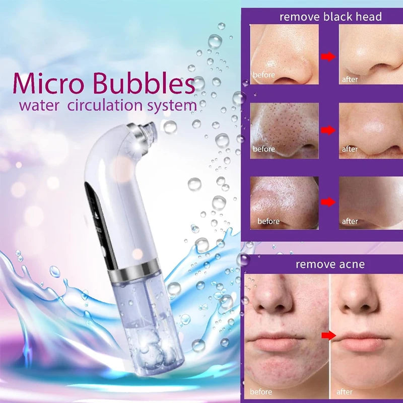 Revitalize your skin with the Water Dermabrasion Hydra Peeling Machine, offering Aqua Facial Clean and Blackhead Removal for a radiant glow.